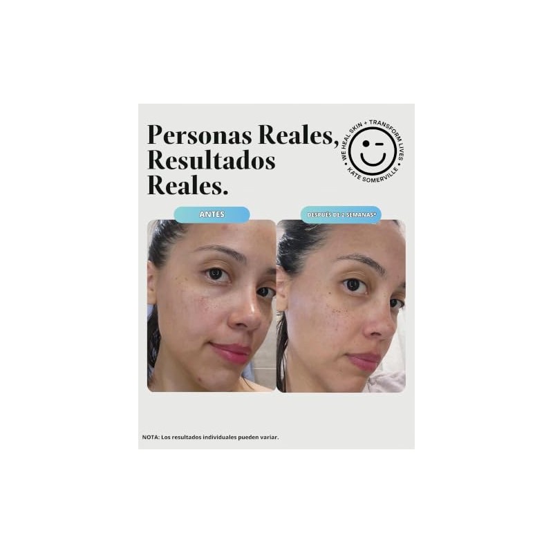 Kate Somerville EradiKate Daily Foaming Cleanser - Acne Face Wash