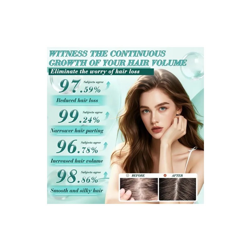 Alpha Infuse, Alphainfuse, Sérum Crecimiento Cabello.