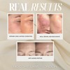 Advanced 3 IN 1 SNAIL MUCIN SUPER SERUM infused with