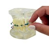 Kemdent Ortho Wax 3 Pack 15 Precut Strips, Metal Recyclable