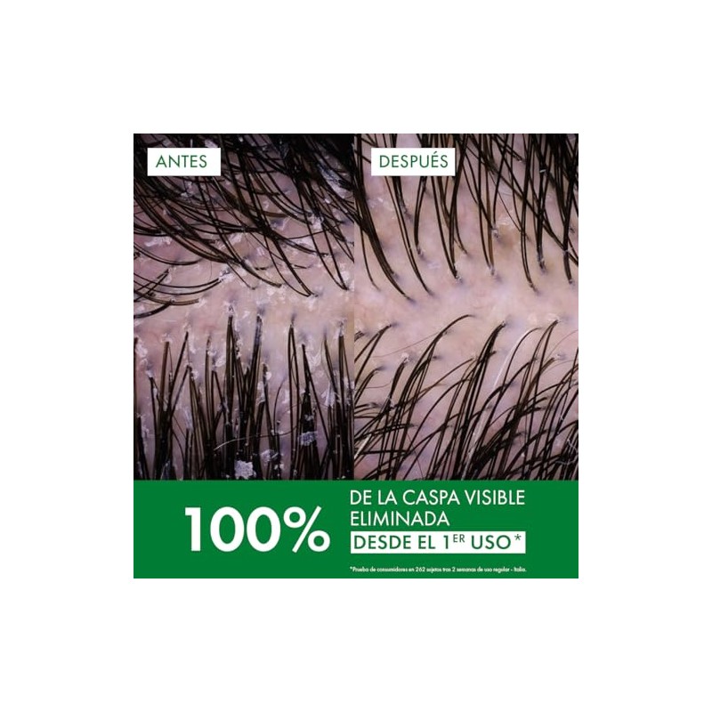 Vichy "vichy dercos caspa grasa 200ml shampoo para combatir la