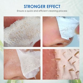 AUSLKA Blackhead Remover Strips,Deep Cleansing Pore Strips For All Skin Types,Black Head Remover For Face & Nose,100PCS-50G