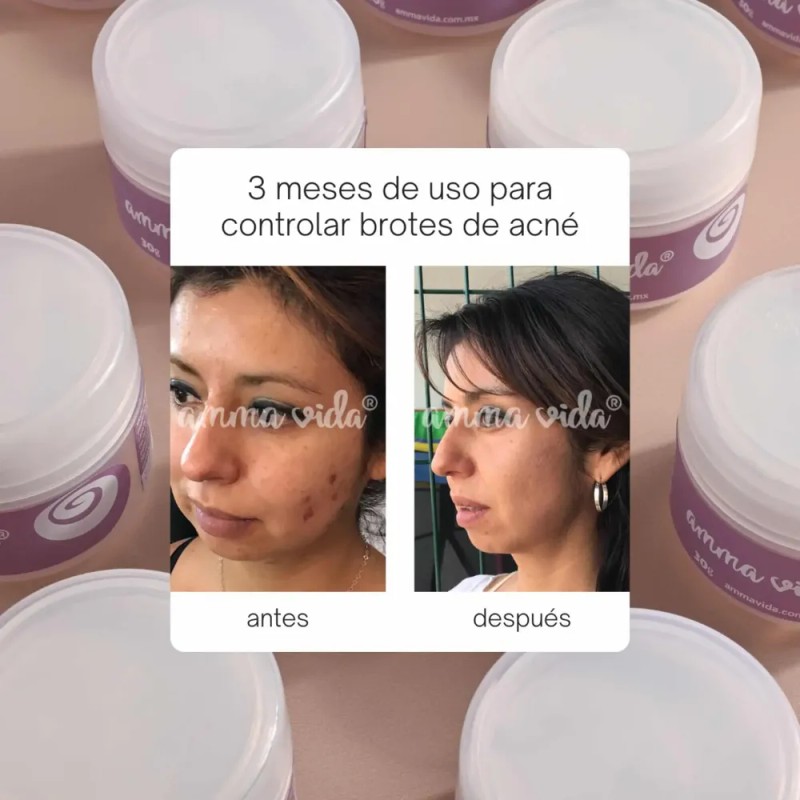 Crema Extra Nutrición Amma Vida, Nutre Tu Piel Y Humecta