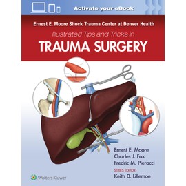 Ernest E. Moore Shock Trauma Center at Denver Health Illustrated Tips and Tricks in Trauma Surgery
