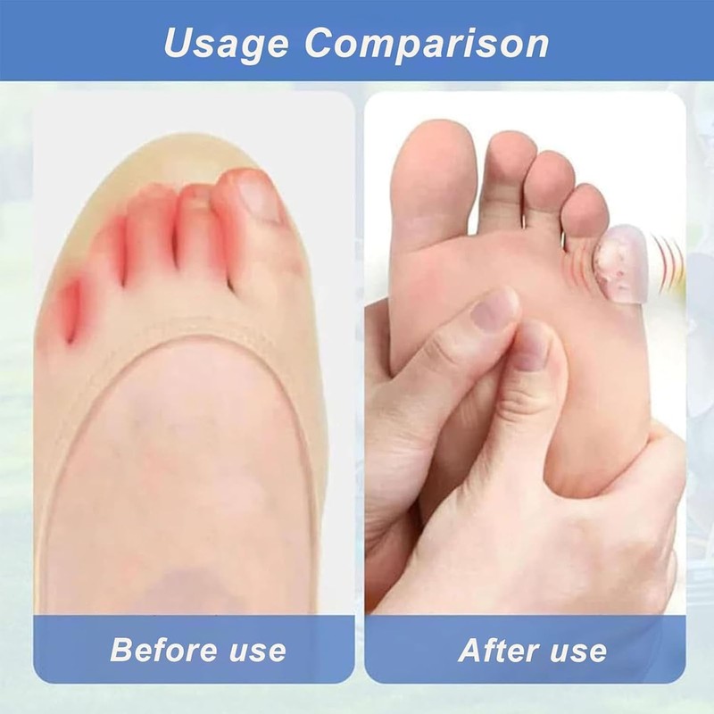 30 Pcs Protectores de Dedos de los Pies, Tapas de