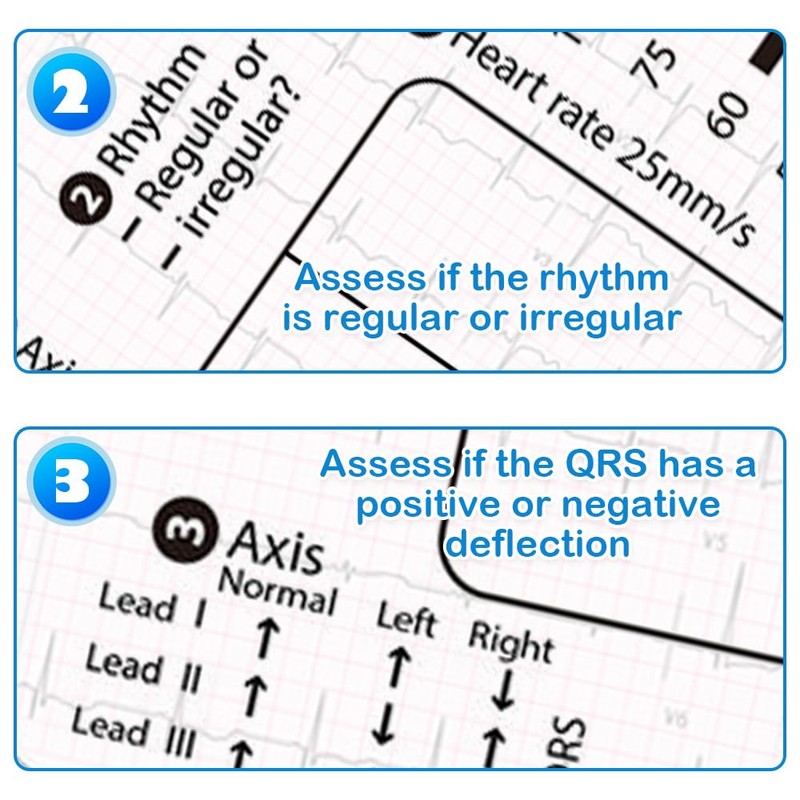 7-Step ECG Ruler, Transparent EKG Measuring Tool, Pocket-Sized 8.6cm x