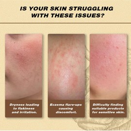 120G Beef Tallow Honey Balm – Ultra-Nourishing Organic Grass-Fed Tallow Cream for Face & Body. Deeply Moisturizing Skin Care for Dry, Sensitive Skin. Natural, Rich Balm to Soothe & Repair