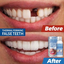 Resin Tooth Repair Glue Shapeable Teeth Gaps Filling Solid Temporary Teeth Repair Falseteeth Glue Safety Broken Fangs - Specification: 1pcs