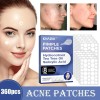 360pcs Breathable Circle Acne Patch Skincare Rapid
