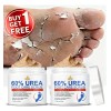 Crema Exfoliante Para Pies Con Urea 60% Y Ácido Salicílico