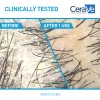 Champú Y Acondicionador Cerave 2 En 1 Hidratante Anticaspa