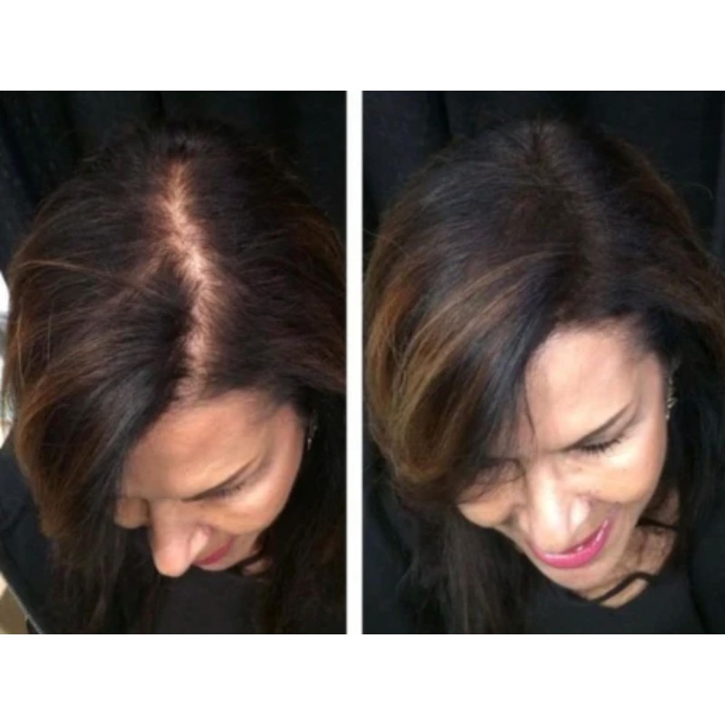 Capelli Fibras Capilares para Pérdida de Cabello, Polvo de Disimulación