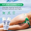 Butt & Thigh Acne Cream – Fast Acting Exfoliating Body