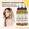 Aceite De Romero Para Cabello, Tratamiento Reparador, Contro