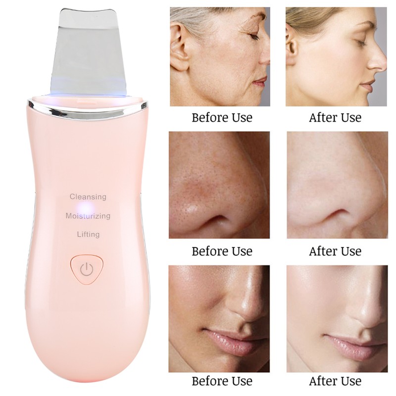 Ultrasonic Skin Scrubber Face Cleaning Vibration Massage Home Beauty MachinePink