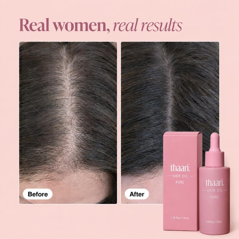 Thaari Hair Growth Oil, 1.76 fl oz (50 ml)