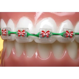 Snapcaps Braces Bumper Cover, Orthodontic Bracket Wax Substitute, Alternative Snap-on Braces Guard Braces Accessories 10 pack (Butterfly)