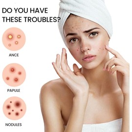 Parches para Espinillas y Acné, para Piel Grasa Mixta o con Imperfecciones Cuidado de Piel con Imperfecciones, Elimina Espinillas, Cubre Manchas, Absorbe Grasa y Trata Rápidamente, 200 Piezas