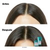 Shampoo Anti Irritación L'Oréal Professionnel Scalp 300ml