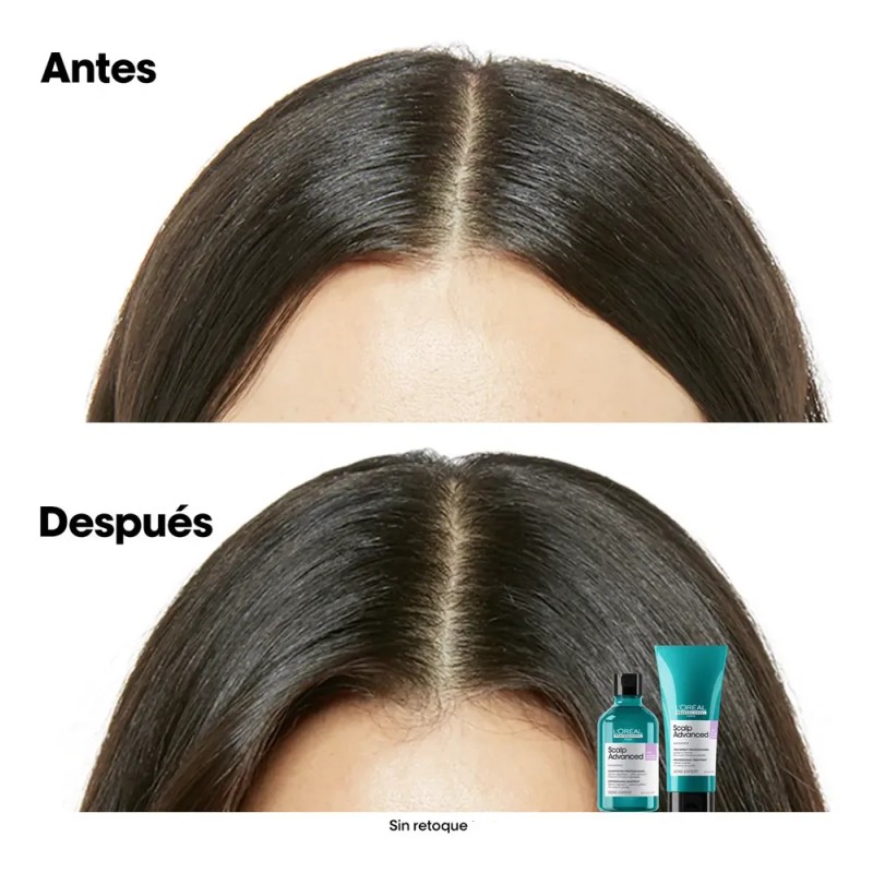 Shampoo Anti Irritación L'Oréal Professionnel Scalp 300ml