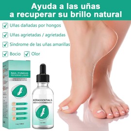 2 Piezas Krassentiales Líquido Reparador de Uñas de Los Pies, Esmalte de Uñas, Esencia de Reparación de Cutículas, Renovación de Uñas Dañadas, Agrietadas y Decoloradas