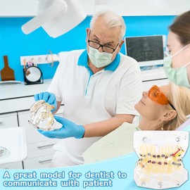 Dental Model with Braces, Orthodontic Dental Model Teeth Model Teeth for Children with Wire Chain Dental Orthodontic, Dental Model Demonstration Tool for Dental Teaching or Oral Care