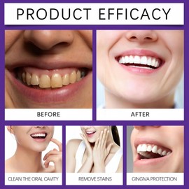 Teeth Restoration Mineral Powder - Strengthens Teeth & Gums, Freshens Breath - Tooth Powder - Natural Dental Care for Oral Health (2PCS)