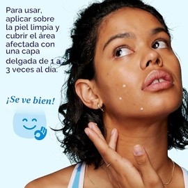 Clean & Clear Persa-Gel 10 Tratamiento para manchas de acné, 1 onza líquida | Topical Pimple Cream, Oil-Free, Maximum Strength 10% Benzoyl Peroxide, V
