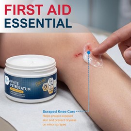 MED PRIDE Pure White Petroleum Jelly – 15 oz Skin Protectant & Moisturizing Ointment for Dry Skin, Cracked Hands & Feet, Chapped Lips, Cuts, Burns, Eczema & Diaper Rash