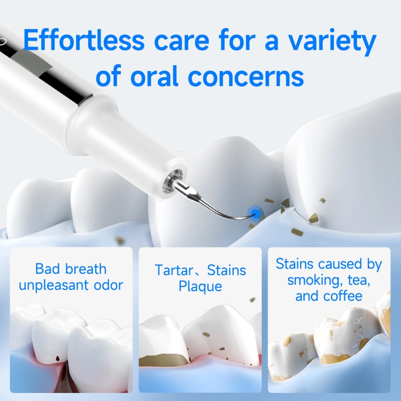 CURVY MOON Household Ultrasonic Teeth Clean Kit Machine Tooth Stain