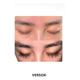 Versox Crecimiento Pestañas - Tratamiento Efectivo