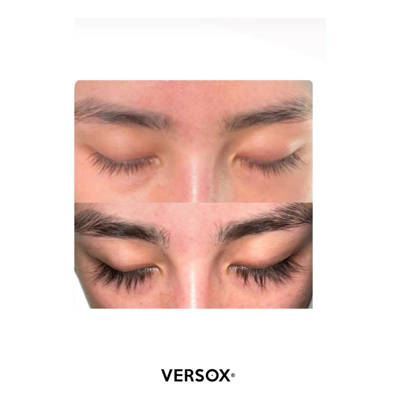 Versox Crecimiento Pestañas - Tratamiento Efectivo