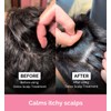 FUL Detox Scalp Treatment, 150ml, with Turmeric and Aloe Vera,