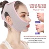 MGPUK Face Contouring Sleeping Mask Chin Strap, Reusable V Line