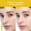 Phofay Sérum Exfoliación Niacinamida Ácido Tendencia Acnéica