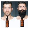 Aceite For El Crecimiento De La Barba O0 Suero For
