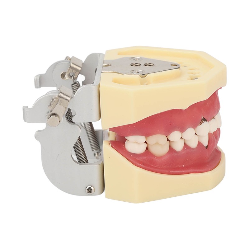 Periodontal Disease Teeth Resin Model Dental Demonstration Teeth Model for