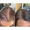 3 Piezas Shampoo Reviving - Farmasi - Set Reviving