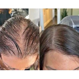 3 Piezas Shampoo Reviving - Farmasi - Set Reviving                                                                                                    
