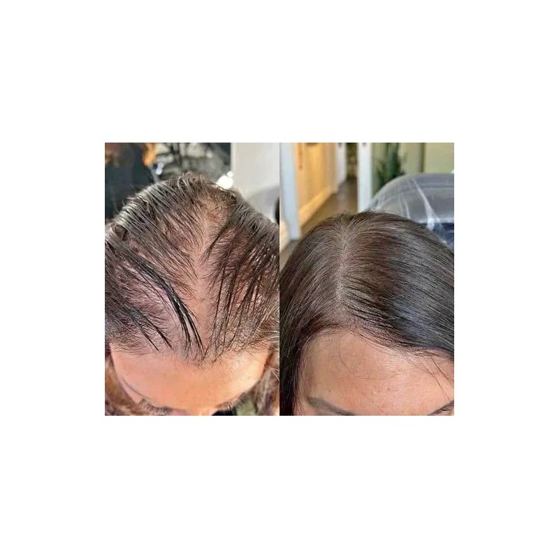 3 Piezas Shampoo Reviving - Farmasi - Set Reviving