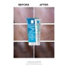 La Roche-Posay Effaclar Duo+M, Anti-Breakout Corrective Gel, 40ml