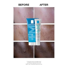 La Roche-Posay Effaclar Duo+M, Anti-Breakout Corrective Gel, 40ml