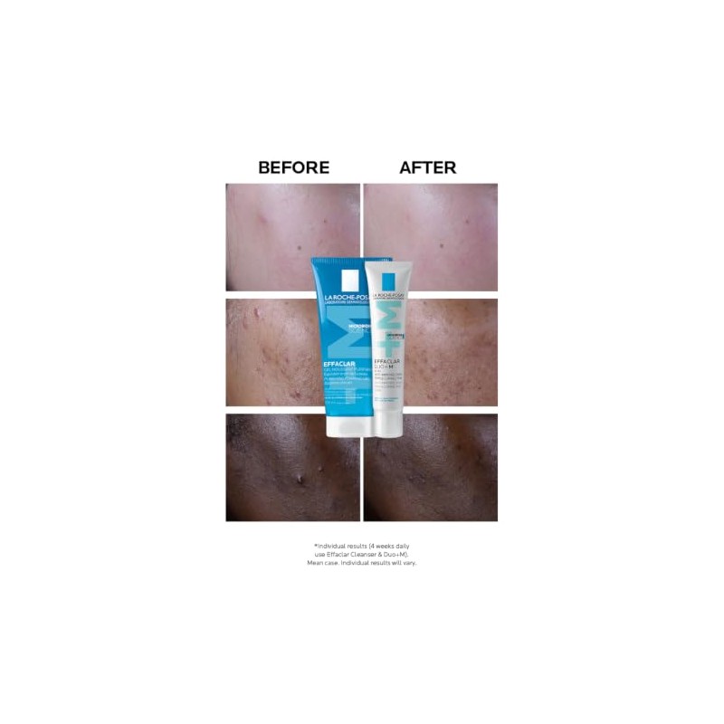 La Roche-Posay Effaclar Duo+M, Anti-Breakout Corrective Gel, 40ml