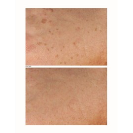 Clear Beauty Intensive Dark Spots & Skin Brightening Cream (BUY 2, GET 1 FREE!)