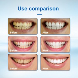 Oumun Whitening Tooth Paint,Instant Whitening Paint for Teeth,Tooth Polish Uptight White,Teeth Whitening Gel,Tooth Paint,Tooth Paint Enamel,Instant Teeth Whitening,Teeth Whiteners,Teeth Bleach,White Teeth