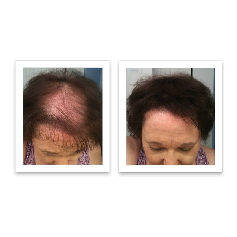 Caboki Hair Loss Concealer Trial Pack (Light Brown)