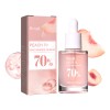 Ho Serum Niacinamida, Aclarante Reduce Poros Hidratante