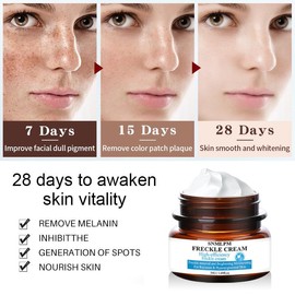 Niacinamide Serum Remove Dark Spots Melasma Chloasma Black Freckle Face Skin Care CreamWhitening Moisture Powerful Removal