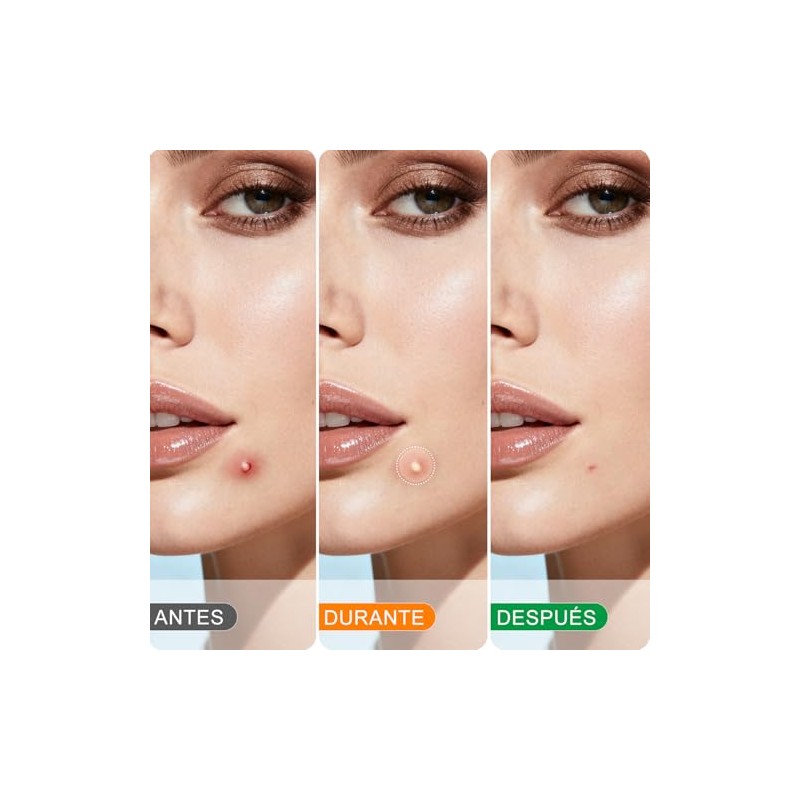 NEARPOW 380 Parches Acné, Pimple Patch Multitamaño Formas Variadas Cara