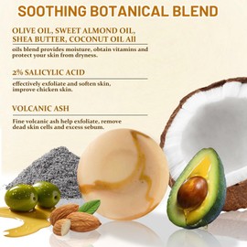 Umpeimvon 3 Pack Handmade Salicylic Acid Soap Exfoliating Bar Soap and Rosehip Oil for Face, Acne Cleanser with Volcanic Ash for Back and Body Strawberry Skin, Restore and Renew Skin, 90g/3.17 oz